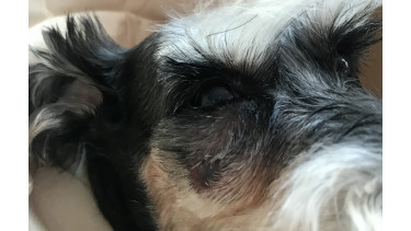 Gum Infection or Melanoma?